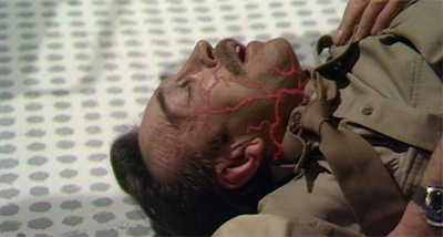 Sadly, not a pretty sick serial...