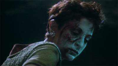 Not just her ego is bruised...