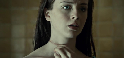 We all carry scars...