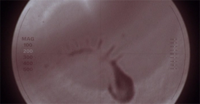 A parasite for sore eyes...