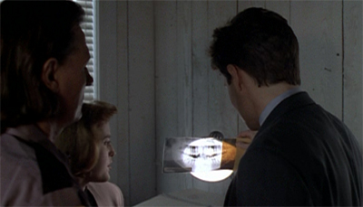 The episode lacks teeth...