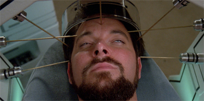 Pulaski's acupuncture skills left a lot to be desired...