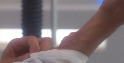 Whatever you do, don't scratch them!