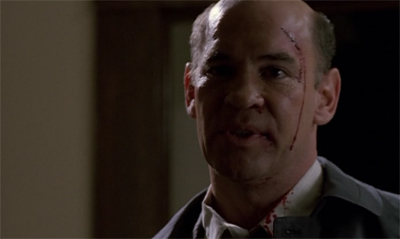 Skinner makes a bloody mess...