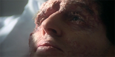 Burnt by the government...