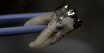 The tooth is out there...