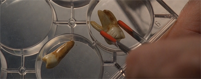 It's like pulling teeth...