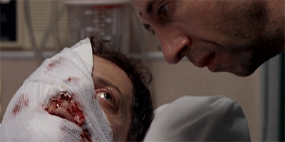 "You'll have to speak up, I'm wearing a bandage."