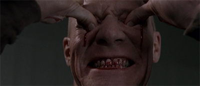 A bleedin' disaster!