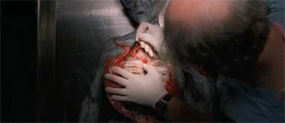 Alien autopsy. For realz.