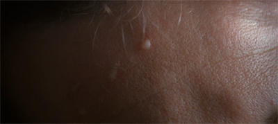 "Strangely, the radiation only casually affected parts of me that are generally off camera! What a convenient development!"