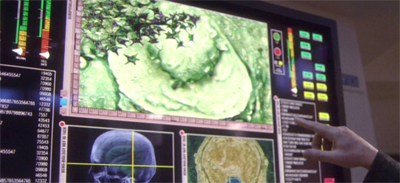 He's got parasites on the brain...