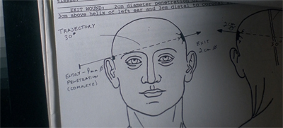 "Put a gun against his head, pulled the trigger now he's back."