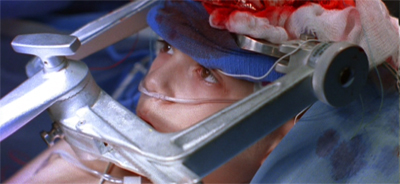 Give his head peace...