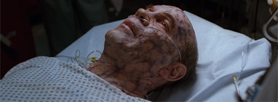 He survived by the Skin(ner) of his teeth...