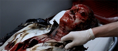 Baldwin, we hardly knew ye...