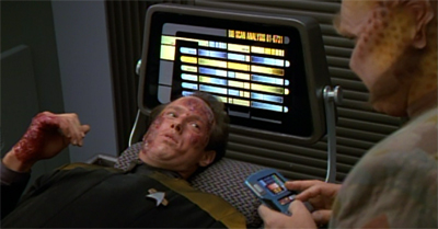 Jonas ends up badly burnt by the Kazon...