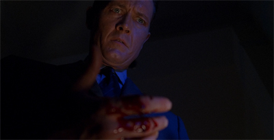 Blood on his hands...