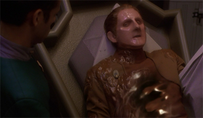 Odo's got the flu(id)...