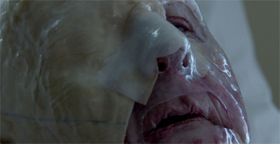 "It's only a flesh wound."