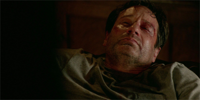 "That wheelchair doesn't sound so bad right now."