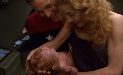 voy-beforeandafter23