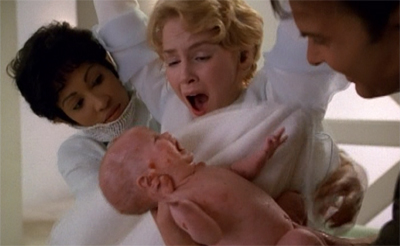 voy-beforeandafter34