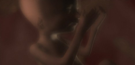 voy-beforeandafter35a