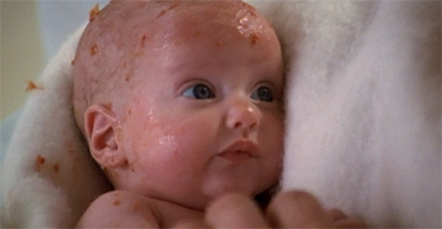 voy-beforeandafter36